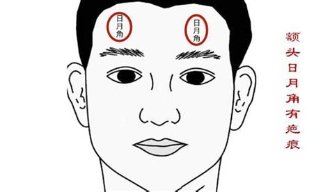 額頭日月角凸起